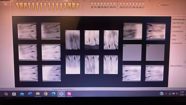 Dental X - rays displayed on a computer screen