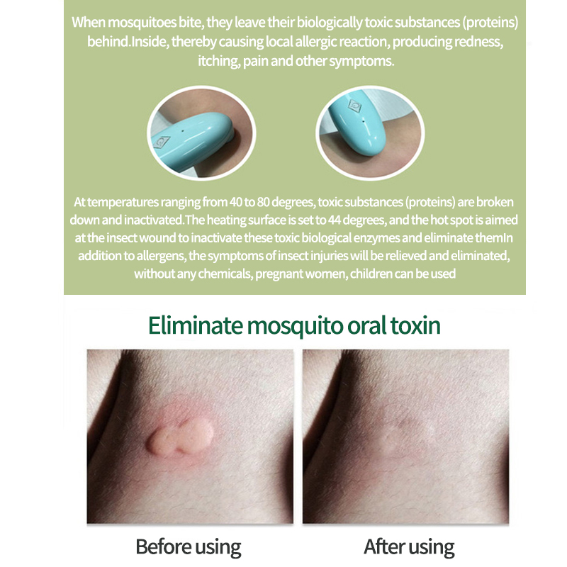 anti-itching stick