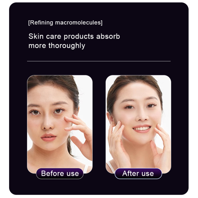 Rechargeable Radio Frequency Skin Tightening RF Facial Beauty Device Eye Lift Massager