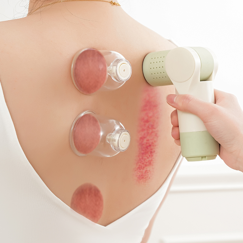 Electric Cupping