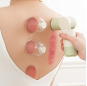 Electric Cupping