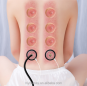 Electric Cupping