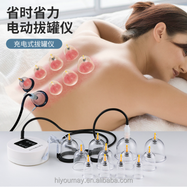 Electric Cupping