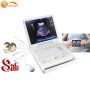 Newest famous brand ultrasound mini 3d ultrasound machine for home use