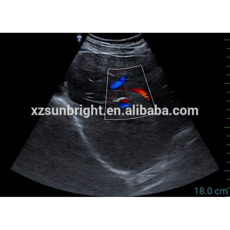 PW synchronous USB linear ultrasound system