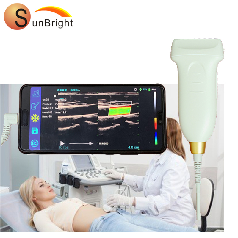 Ultrasuoni USB con sonda lineare ad alta frequenza SUN-D2 per computer portatile