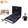 Newest 3D PW lg ultrasound machine ob scan machine ultrasound scanner