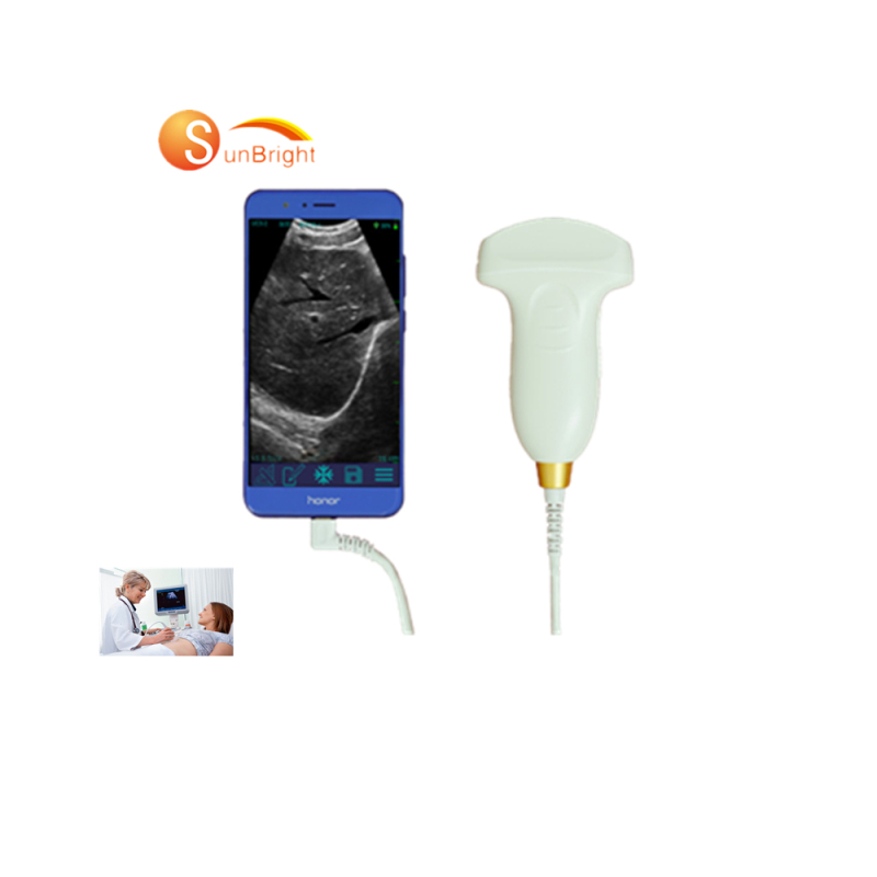 NEW product medical ultrasound scanner smart USB convex usb ultrasound probe price ultrasound probe wireless
