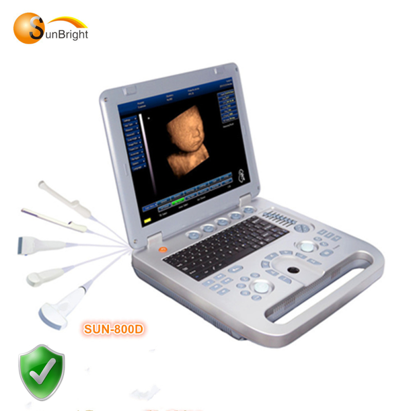 Satisfied and reliable performance 3D ultrasound echo