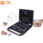 Obstetric 3D ultrasound machine low cost color doppler equipment price