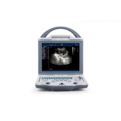 Veterinary machine cheap vet portable ultrasound used for animal pregnancy scanning