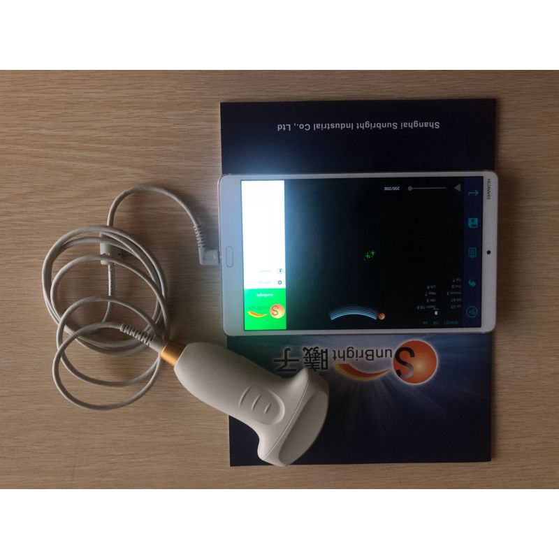 Best ultrasound machine wifi mini USB Convex probe