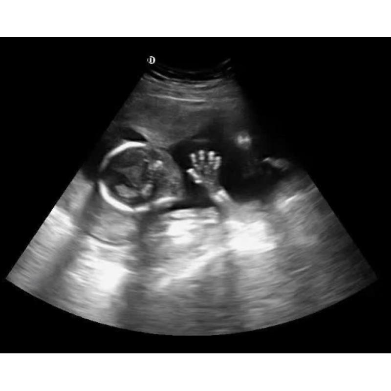 Portable laptop style ecografo portatil color doppler ultrasound scanning medical equipment