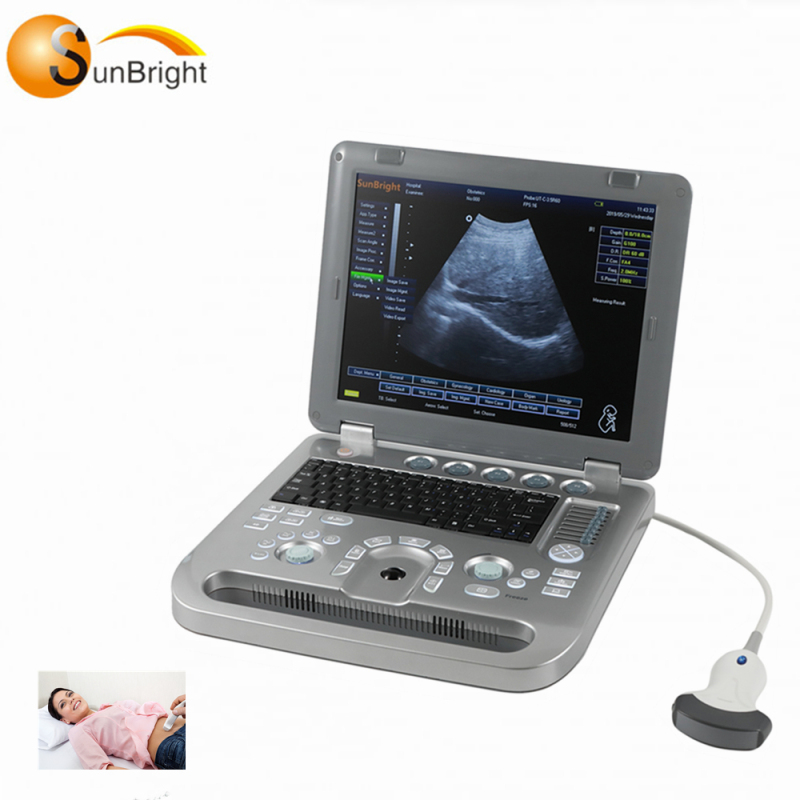 Medical examination OB scan use echo machines for sale portable ultrasound 3D