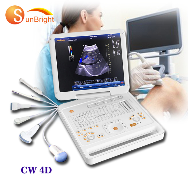 Real time 4d ultrasound scanner color Doppler 4D sonography medical ultrasound ecografo