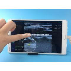 Good Medical use Linear probe USB ultrasound skeletal muscle testing system