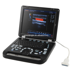 128 elements 3D Sunbright digital medical portable new color ultrasound machine with convex probe