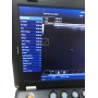 Portable 2D 3D ultrasound color doppler ultrasound machine medical echo machine