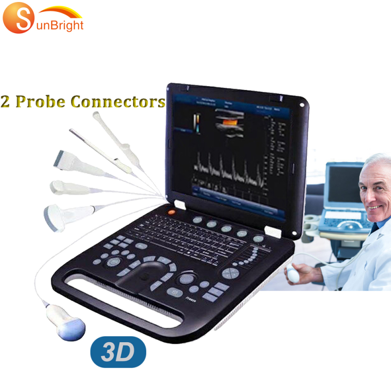 SUN-906A Laptop 3D Máquina de ultrasonido Color Doppler Vascular MSK Scan Dispositivo de ultrasonido