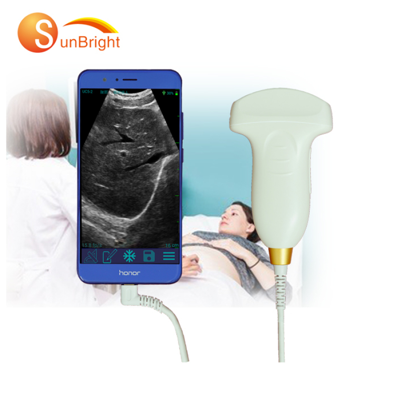 sonda ad ultrasuoni portatile USB 5 MHz completamente digitale ad alte prestazioni per la connessione dello schermo