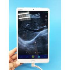 Wifi ultrasound USG wireless ultrasound probe connector IOS android mobile device