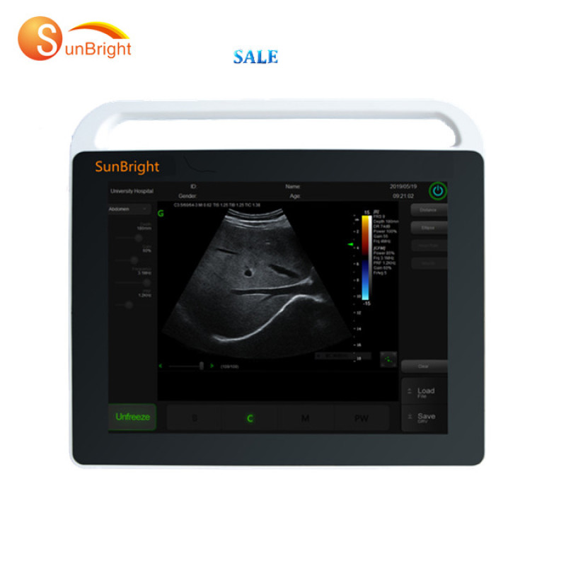 Best price ultrasound Hand-carried Portable touch screen ultrasound midical machine
