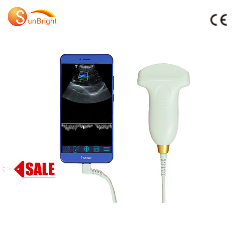 Factory price Portable wireless color doppler convex probe doppler mini ultrasound probe