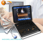high end 4D laptop fetal monitor ultrasound transducer color Doppler scanner