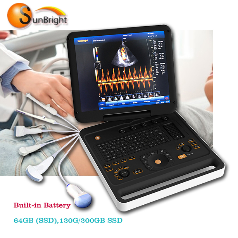 laptop 3D 4D CW color Doppler medical ultrasound scanner for skin