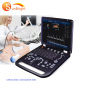 hot sale full digital medical 4d portable 192 element doppler ultrasound machine cheaper price