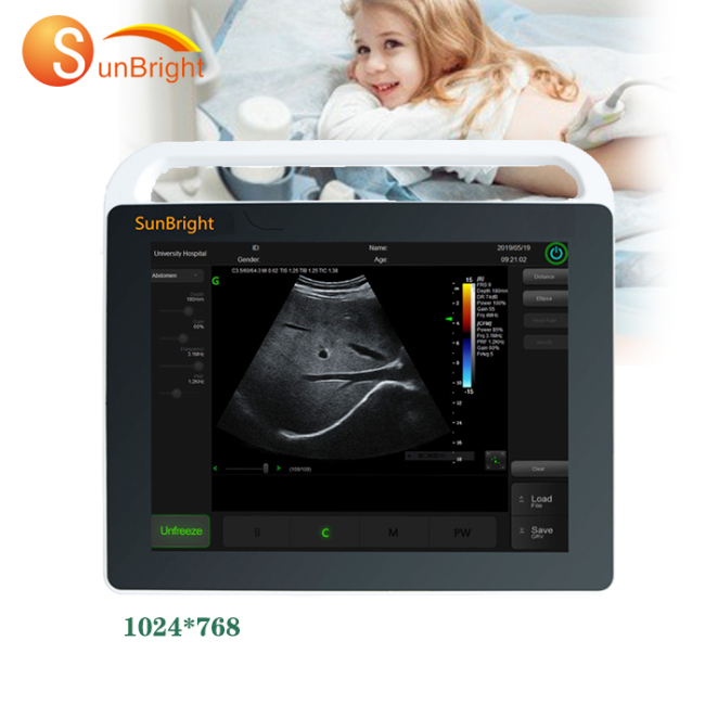 Handheld full digital echo machine portable general electric ultrasound with 15.1 inch screen