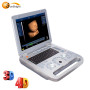 Hot sale portable digital 3D ultrasound machine scanner price