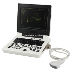 12 inch cheapest Portable 2D Ultrasound Scanner with keyboard