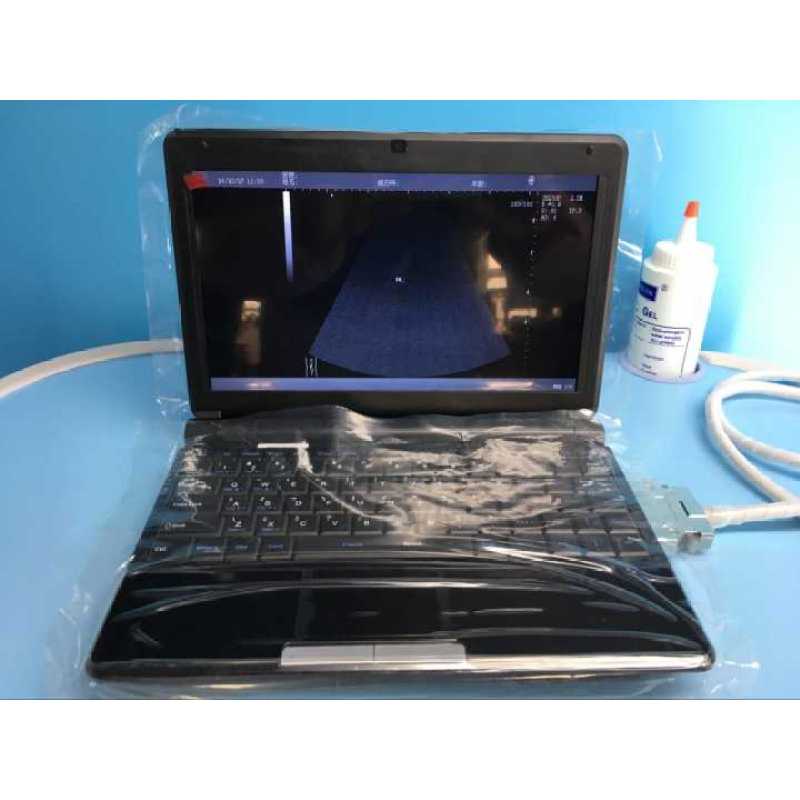 Hot sale! Medical ultrasound machine B W MINI laptop ultrasound diagnostic equipment