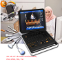 trolley colour doppler ultrasound scanner Medical equipment portable PC-based system