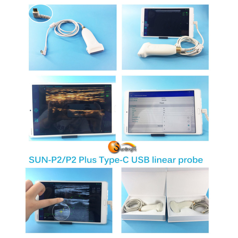 Hot sale Smart  factory price portable usb medical  ultrasound linear probe ultrasound for sale