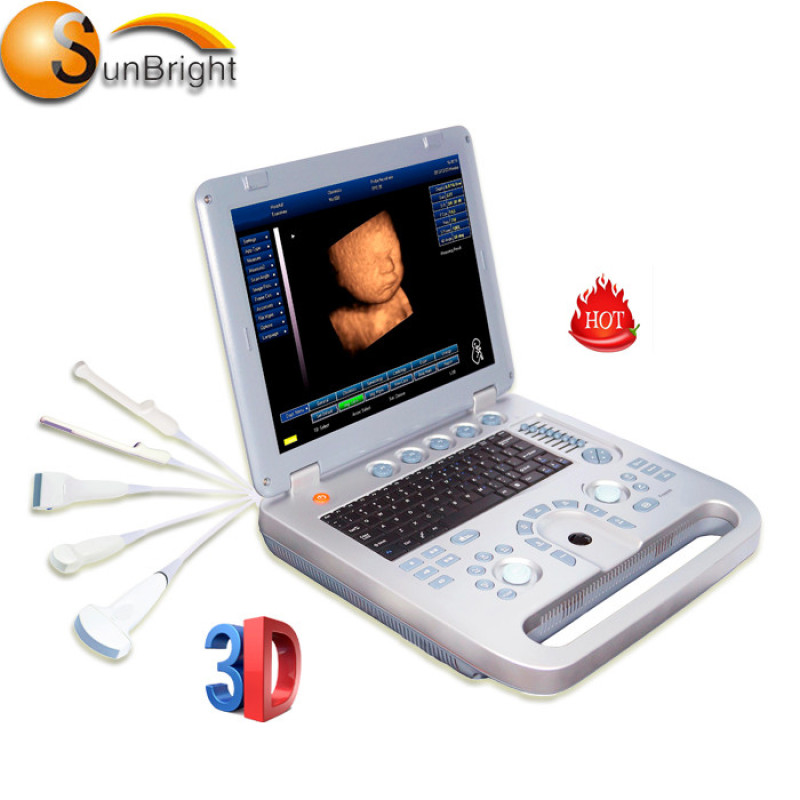 Super Qualität billigste Laptop 3D Ultraschallgerät kann Videodrucker anschließen