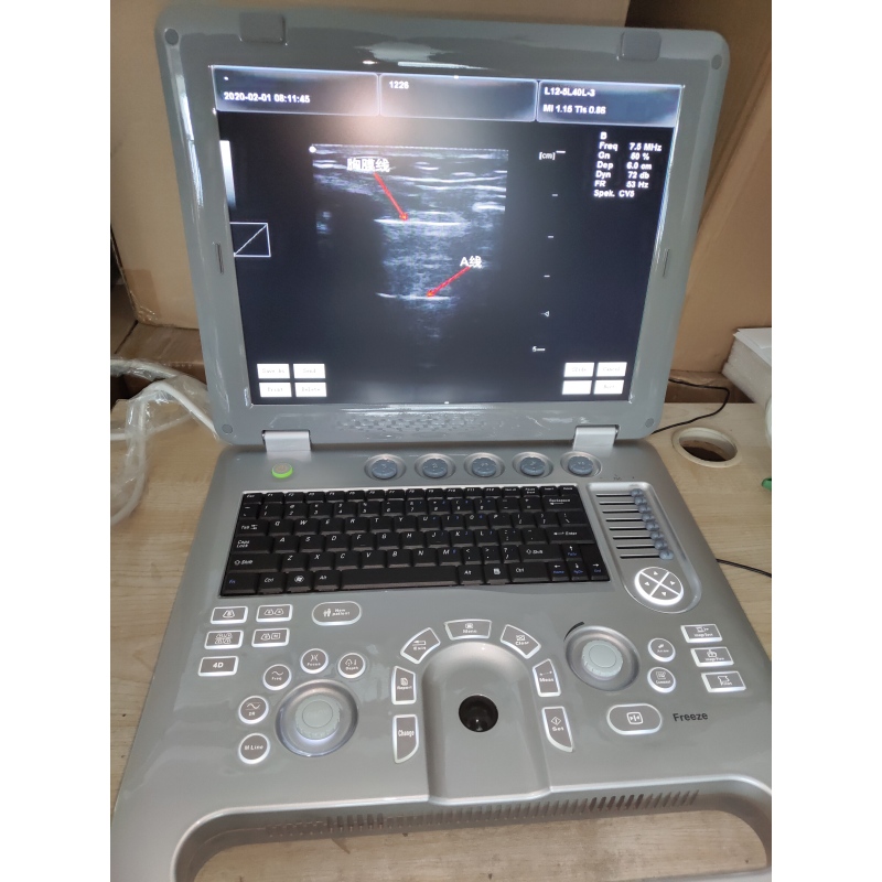 portable cheapest multi-function  ultrasound machine for sale