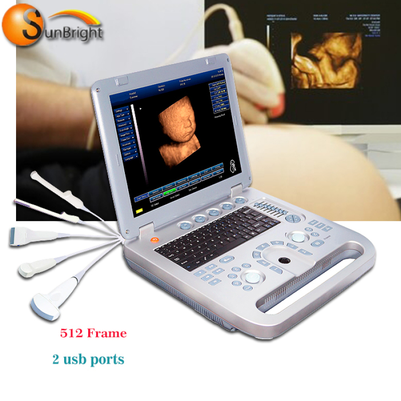 Високопродуктивний портативний клінічний 3D 4D ультразвуковий апарат