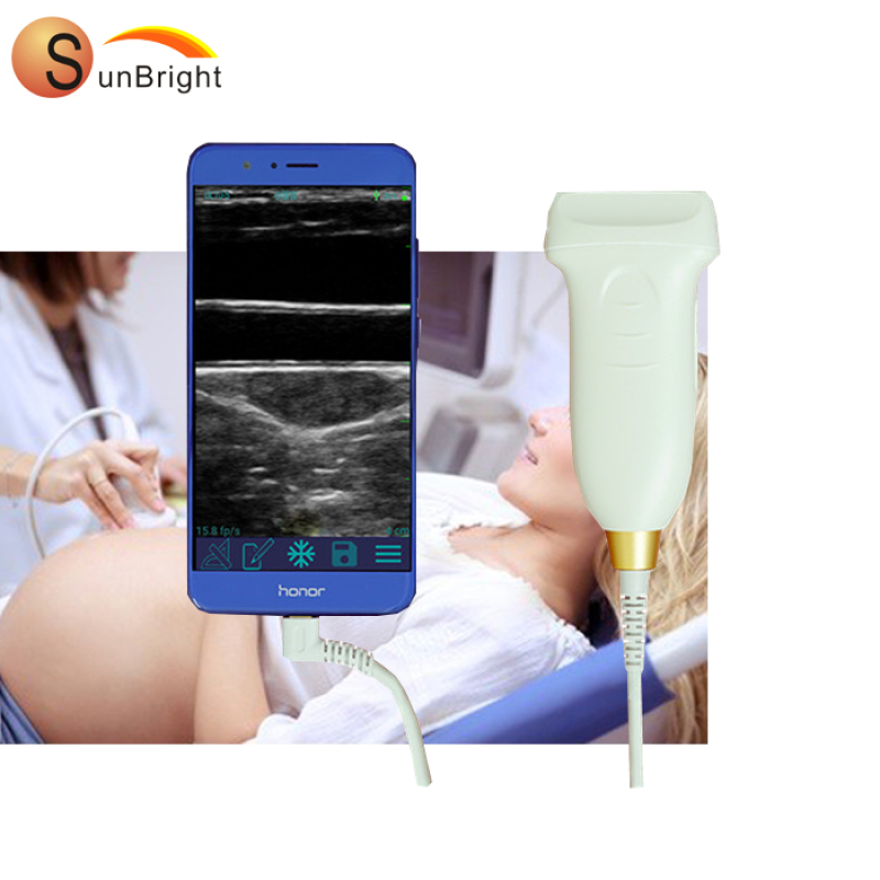 سهل الحمل USB Linear Probe 7.5Mhz 128 Elements ماسح الموجات فوق الصوتية USB الموجات فوق الصوتية منخفضة السعر 128 عنصرًا