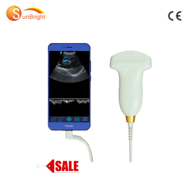 128 Elements Wifi doppler ultrasound USG For Android Mobile Device Wireless Ultrasound Probe