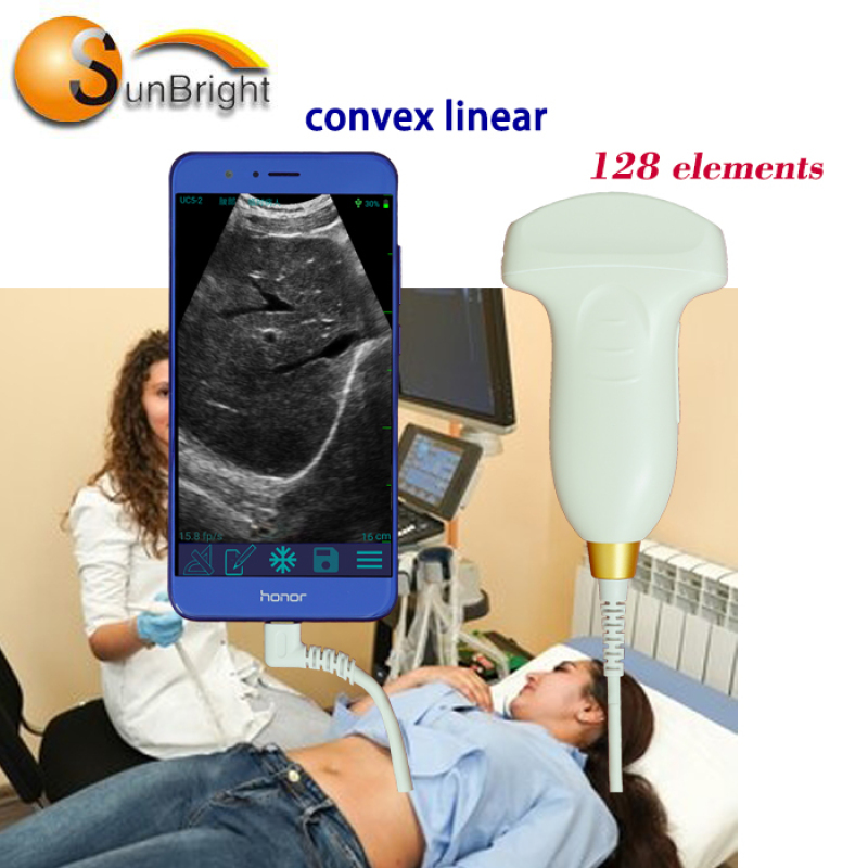 128 elements wireless color doppler convex usg ultrasound probe