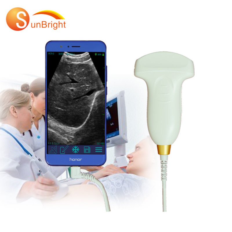 Розумний, найдешевший USB-конвексний портативний ультразвуковий зонд 2020 року з CE