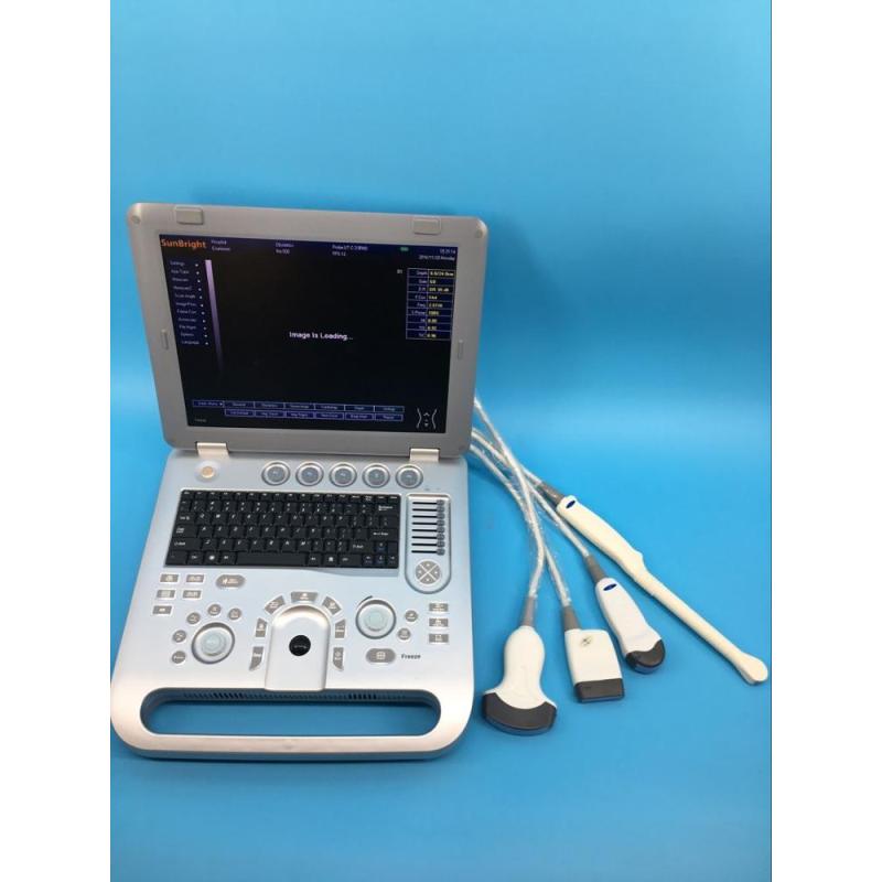 portable home baby ultrasound machine