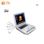 뜨거운 노트북 컬러 초음파 좋은 가격 3D 휴대용 초음파 스캐너 기계