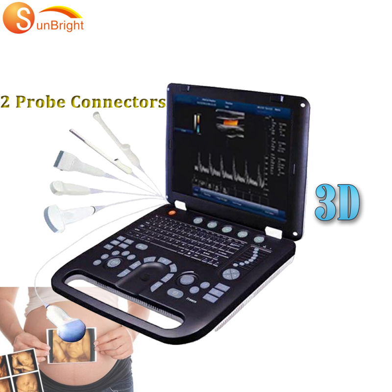 SUN-906A المعدات الطبية أمراض النساء التشخيصية منصة الكمبيوتر ثلاثية الأبعاد دوبلر اللون بالموجات فوق الصوتية