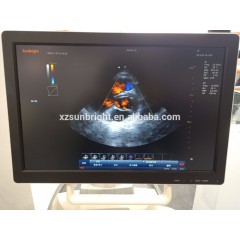 Trolley Color Doppler 4D Ultrasound Machine price