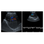wireless usg ultrasound probe Dual probe head new USB Doppler ultrasound diagnosis color transducer