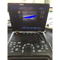 vascular portatil espectral ecografia high end 3D color Doppler scanner