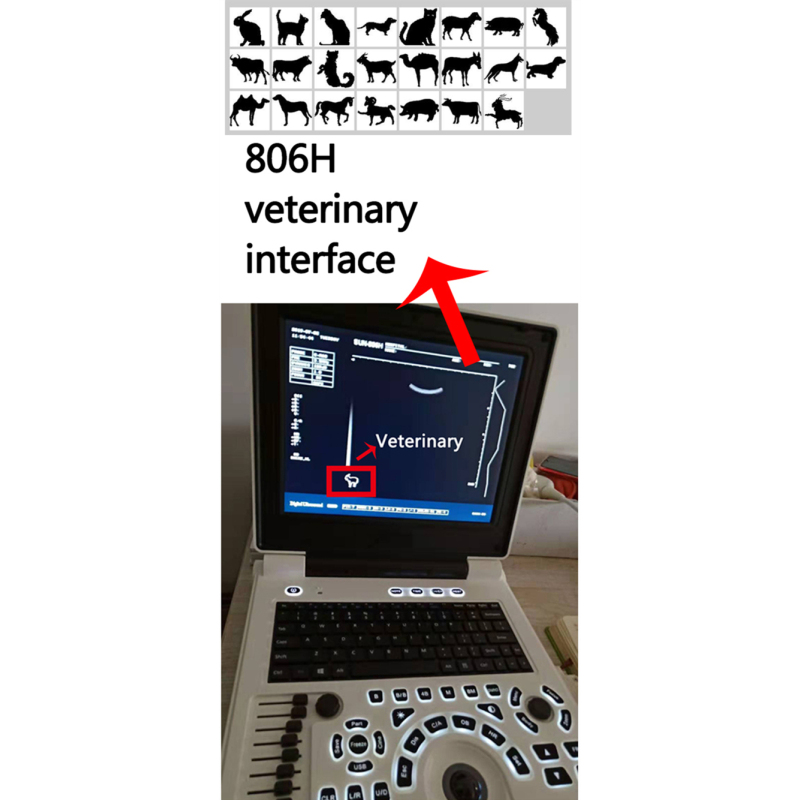 Medical Echocardiography 2D 3D image portable ultrasound device price